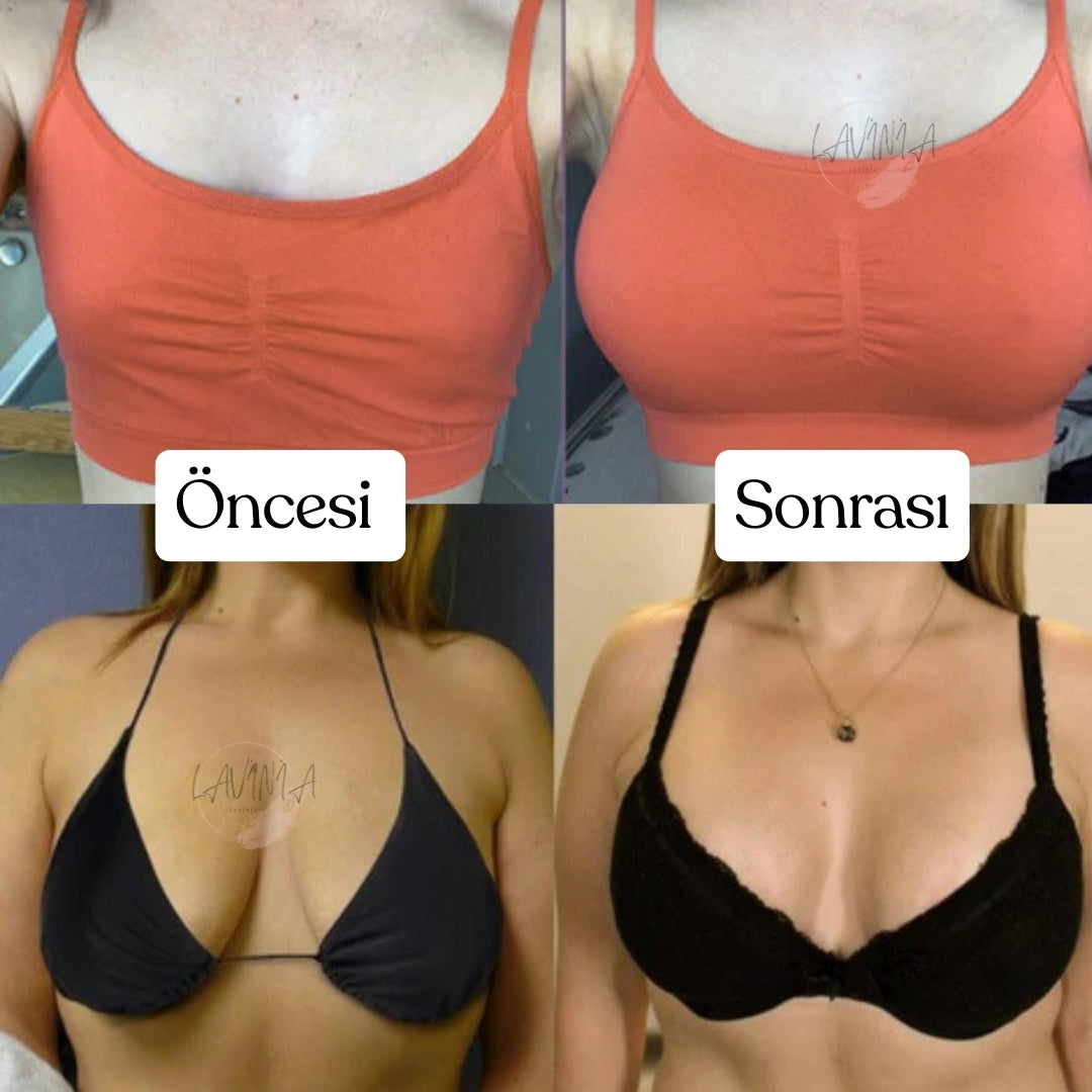 Lavinialuxe® Kollajen Göğüs Büyütme Bandı + EMS Hediye