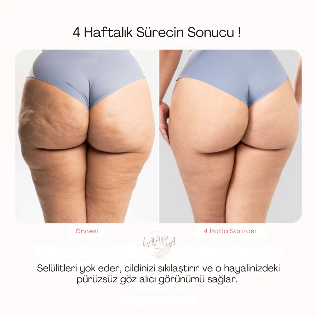 Lavinialuxe® Vakumlu Selülit Masaj ve Vücut Sıkılaştırma Cihazı