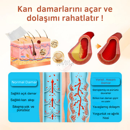 Lavinialuxe® Varis Tedavi Bandı | Şişlik, Yorgunluk ve Damar Sağlığı için Doğal Bitkisel Terapi