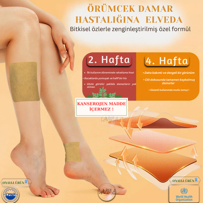 Lavinialuxe® Varis Tedavi Bandı | Şişlik, Yorgunluk ve Damar Sağlığı için Doğal Bitkisel Terapi