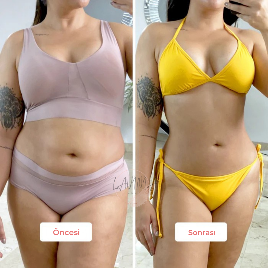 Lavinialuxe® Vakumlu Selülit Masaj ve Vücut Sıkılaştırma Cihazı